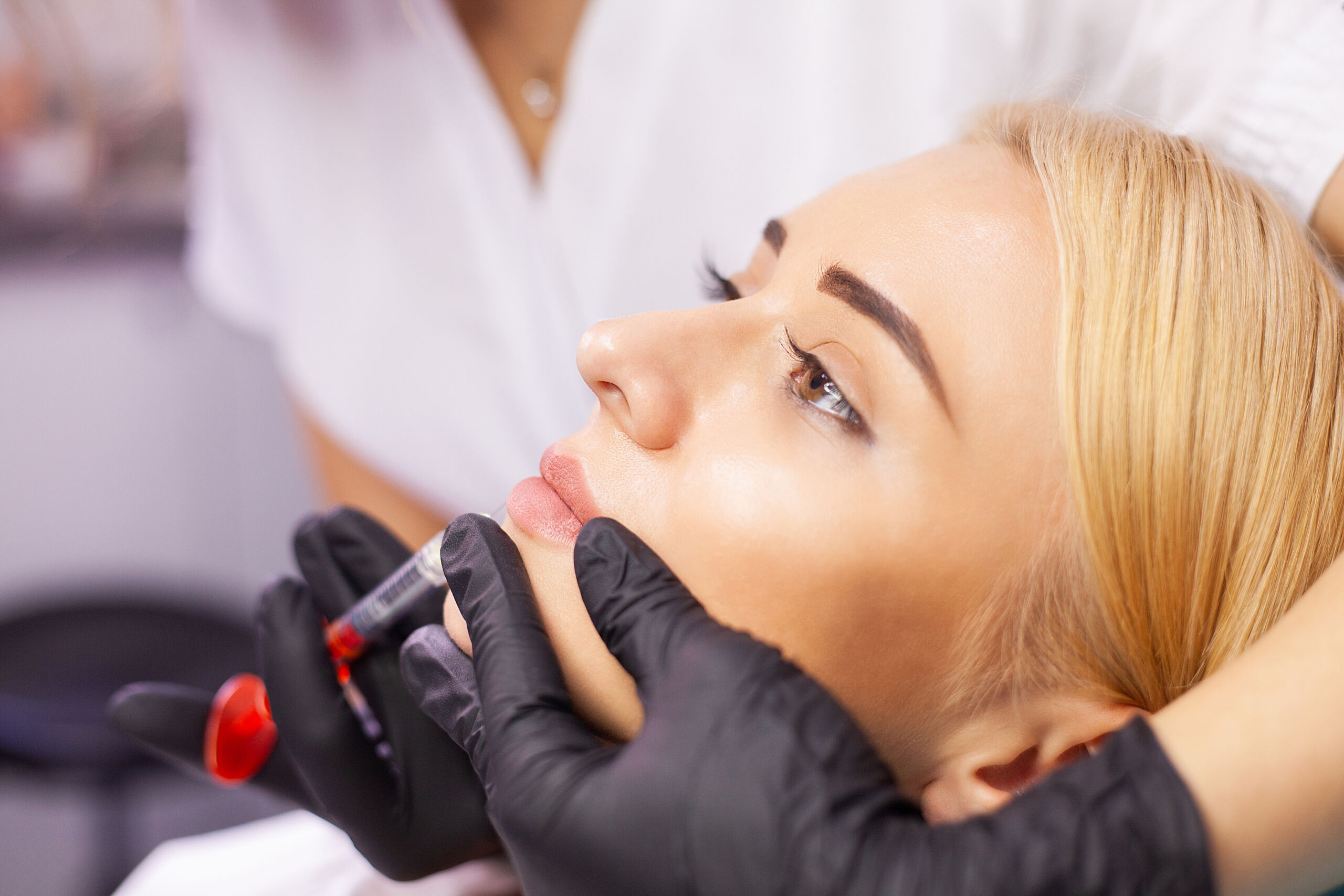 DERMAL FILLERS